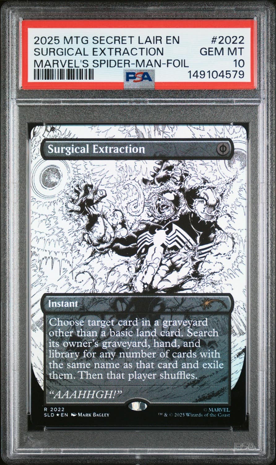 Surgical Extraction