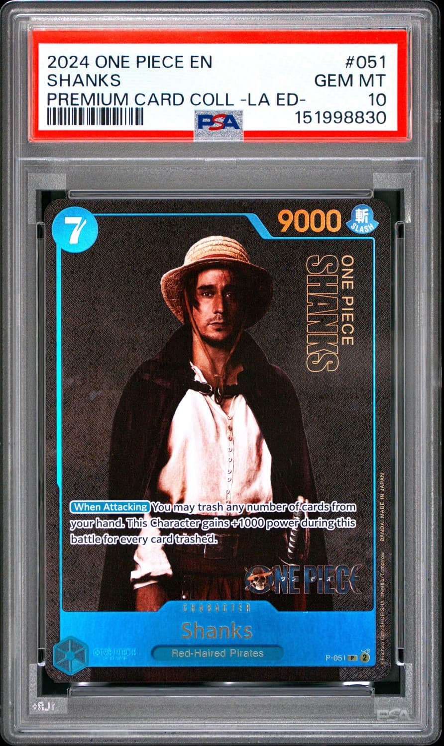 Shanks
