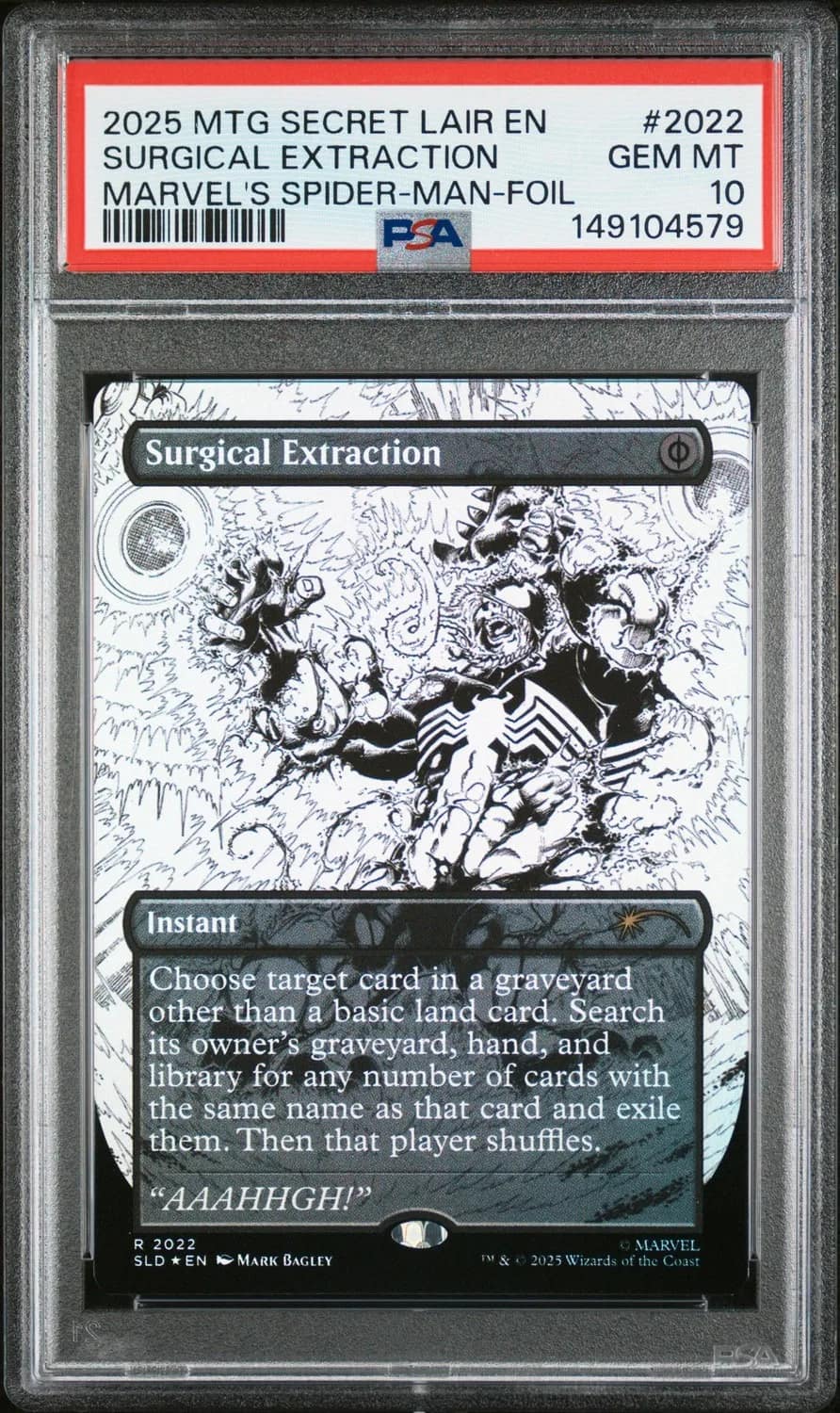 Surgical Extraction